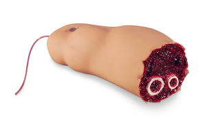 Simulaids Amputated Leg Smart Stat