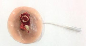 Simulaids Xtreme Open Fracture Clavicle