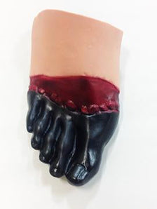 Simulaids Frostbite Of The Foot
