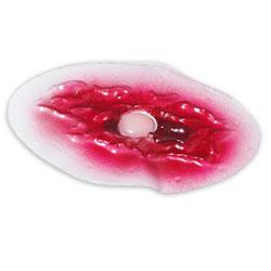 Simulaids Bladder Wound Simulation Model