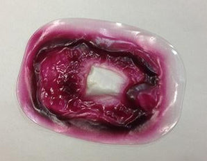 Simulaids Comp.Fracture Humerus Stickon