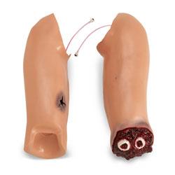Simulaids Arm Flash Moulage