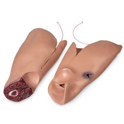 Simulaids Leg Flash Moulage