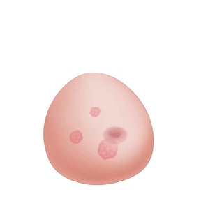 Nasco SONOtrain Breast Model with Tumors