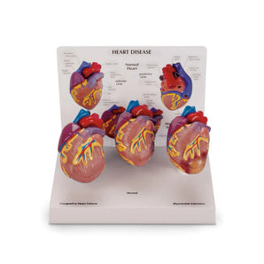 Simulaids 3-Piece Mini Heart Set Models