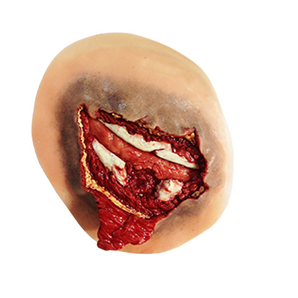 Simulaids Open Rib Fracture Moulage