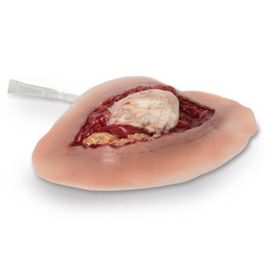 Simulaids Open Ankle Dislocation Moulage