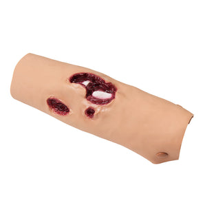 Simulaids Compound Tibia Fracture Leg Model