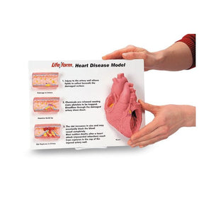 Simulaids 3D Heart Disease Display Model