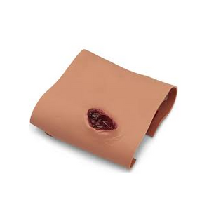 Simulaids Projectile Wound – Arm Entry & Exit Model