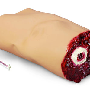 Amputated Arm for SMART STAT