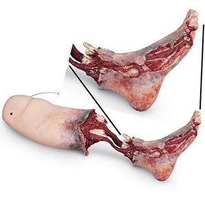 Simulaids Smart Stat Xtreme Trauma Bleeding Leg