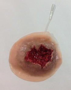 Exit Gunshot Wound – Palm Simulator