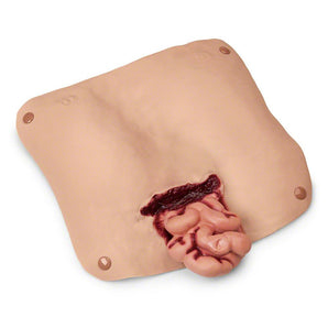 Abdominal Wound Trainer