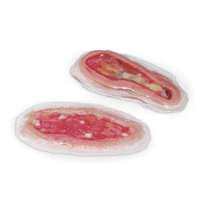 Dehiscence Wound Model – ST2