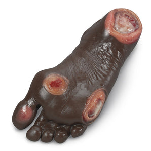 Simulaids Pressure Ulcer Foot Dark