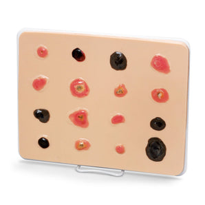 Simulaids Skin Cancer Trainer Light