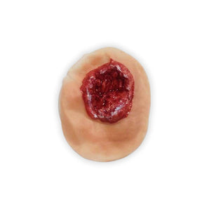 Electrical Burn – Palm Wound Simulator