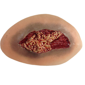 Simulaids Skin and Muscle Laceration Moulage