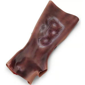 Burn Simulation Forearm – 2nd & 3rd Degree