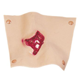 Compound Humerus Fracture Simulation