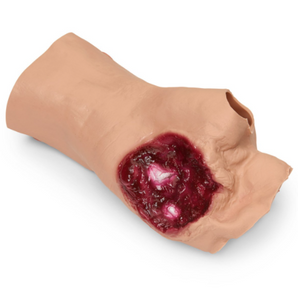 Gunshot Wound Simulation – Palm