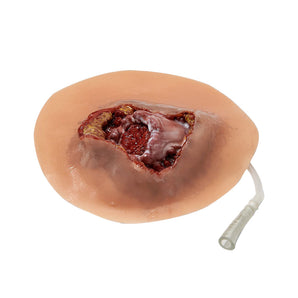 Simulated Open Fracture Trainer – Humerus